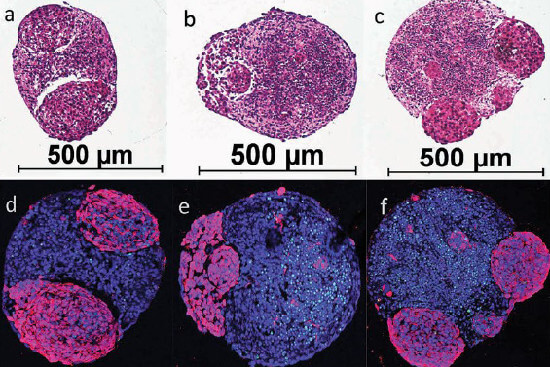 Menschliche Mini-Brains