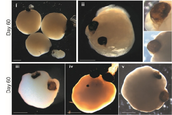 Brain Organoid