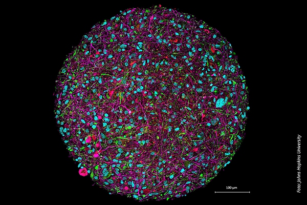 Organoid-Intelligenz