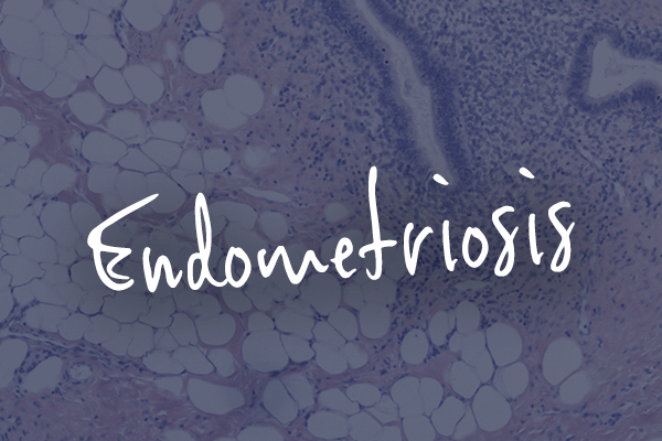 eng endometriosis